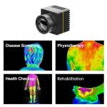 Uncooled 384x288/17µm Thermal Imaging Module for Medical Diagnosis & Temperature Screening